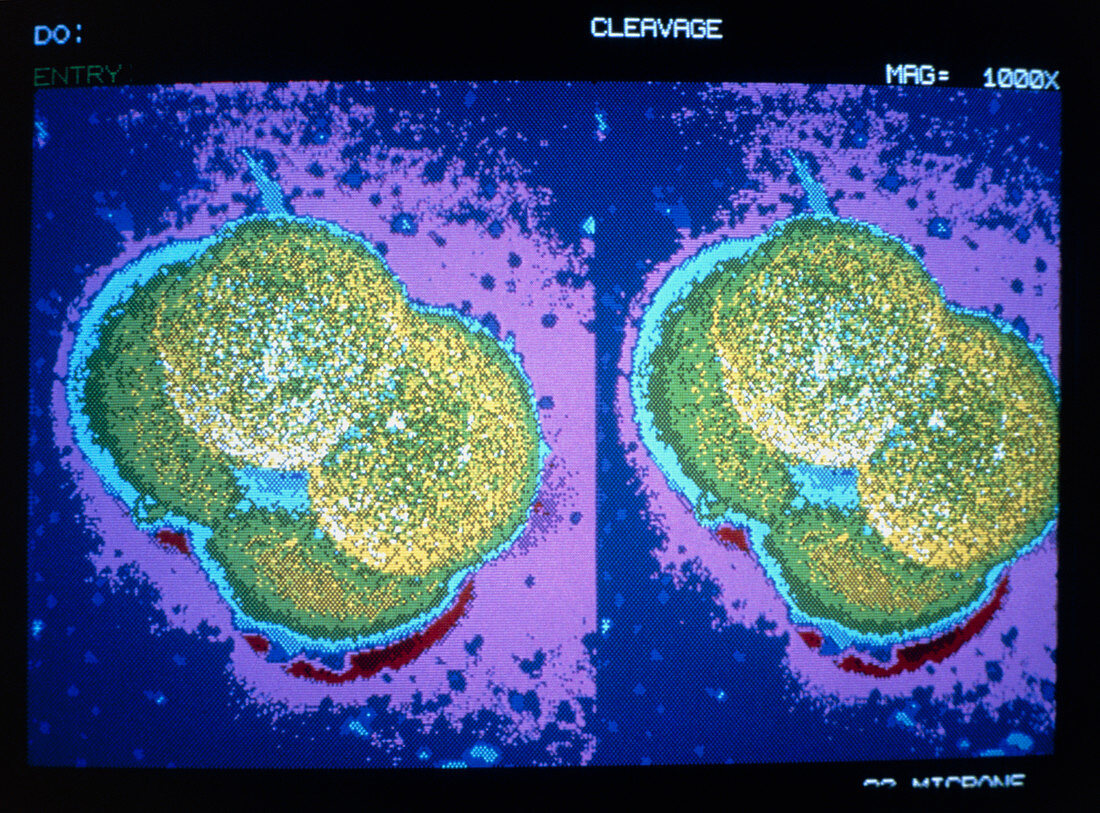 Two views of cell cleavage in embryo