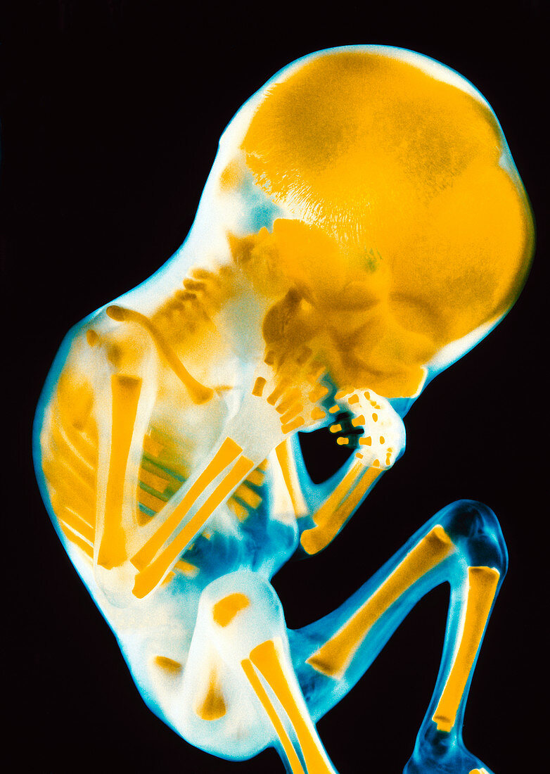 Foetal skeleton
