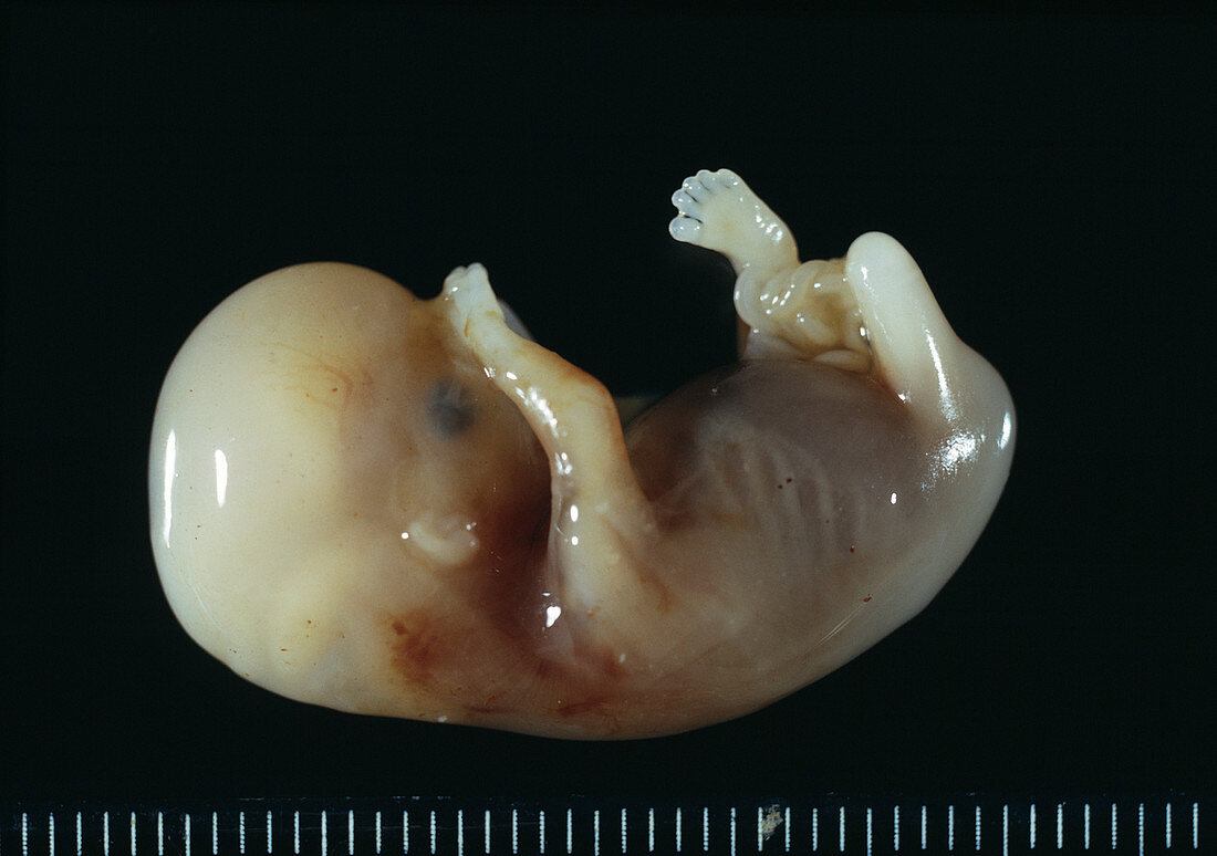 Seven-week-old embryo