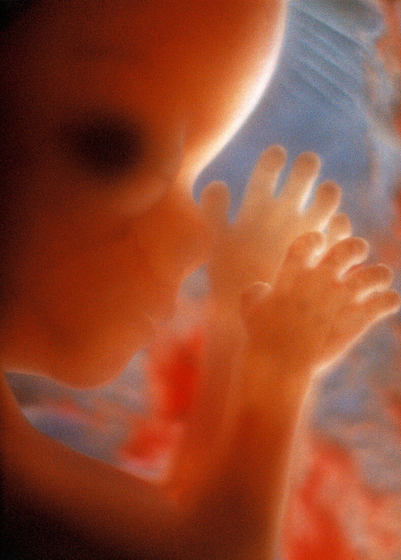 Foetus aged 14 weeks