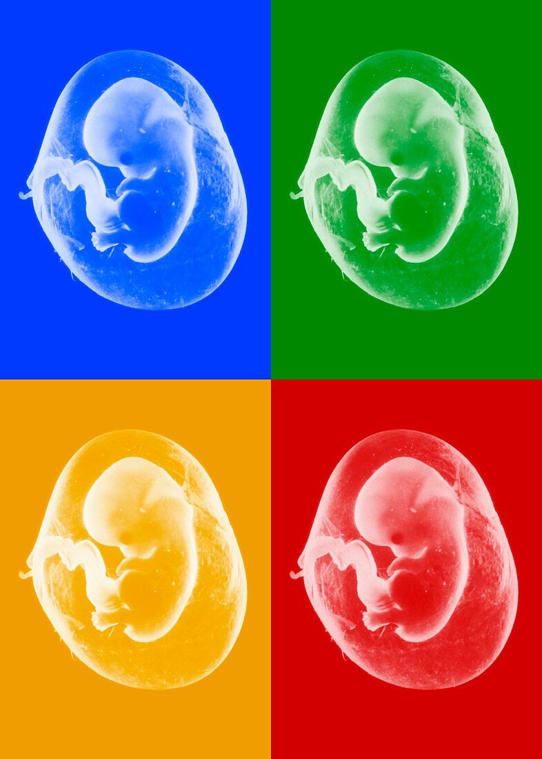 Eight-week-old foetuses