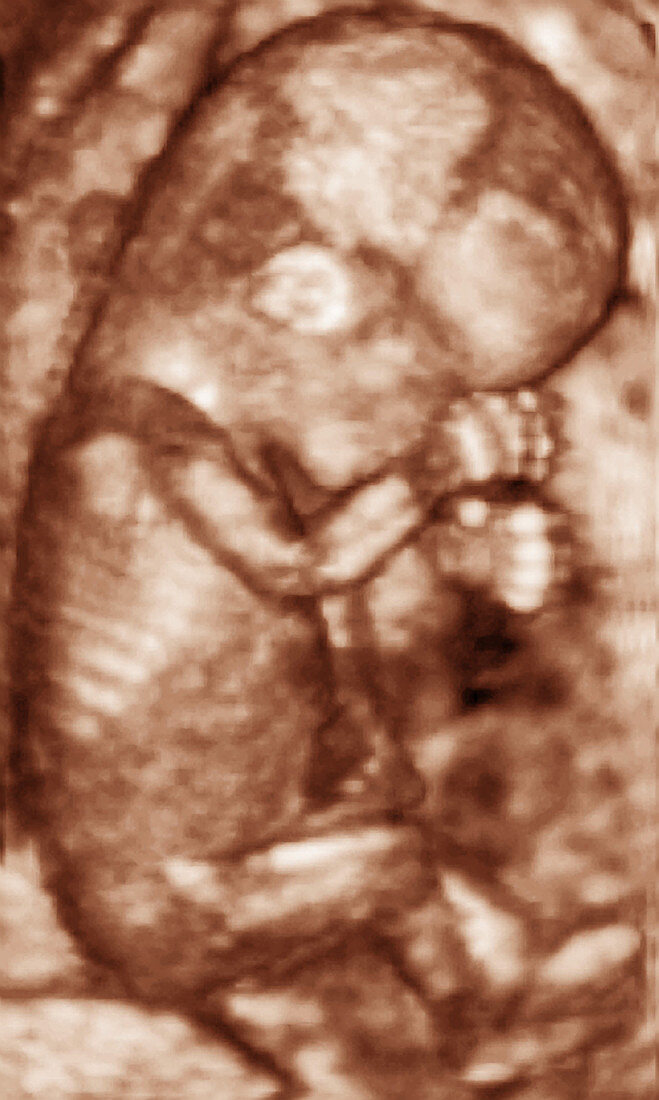 12 week foetus,3-D ultrasound scan