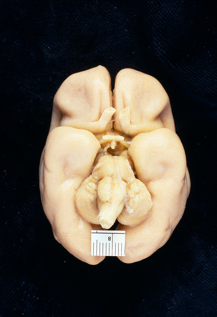 Foetal brain
