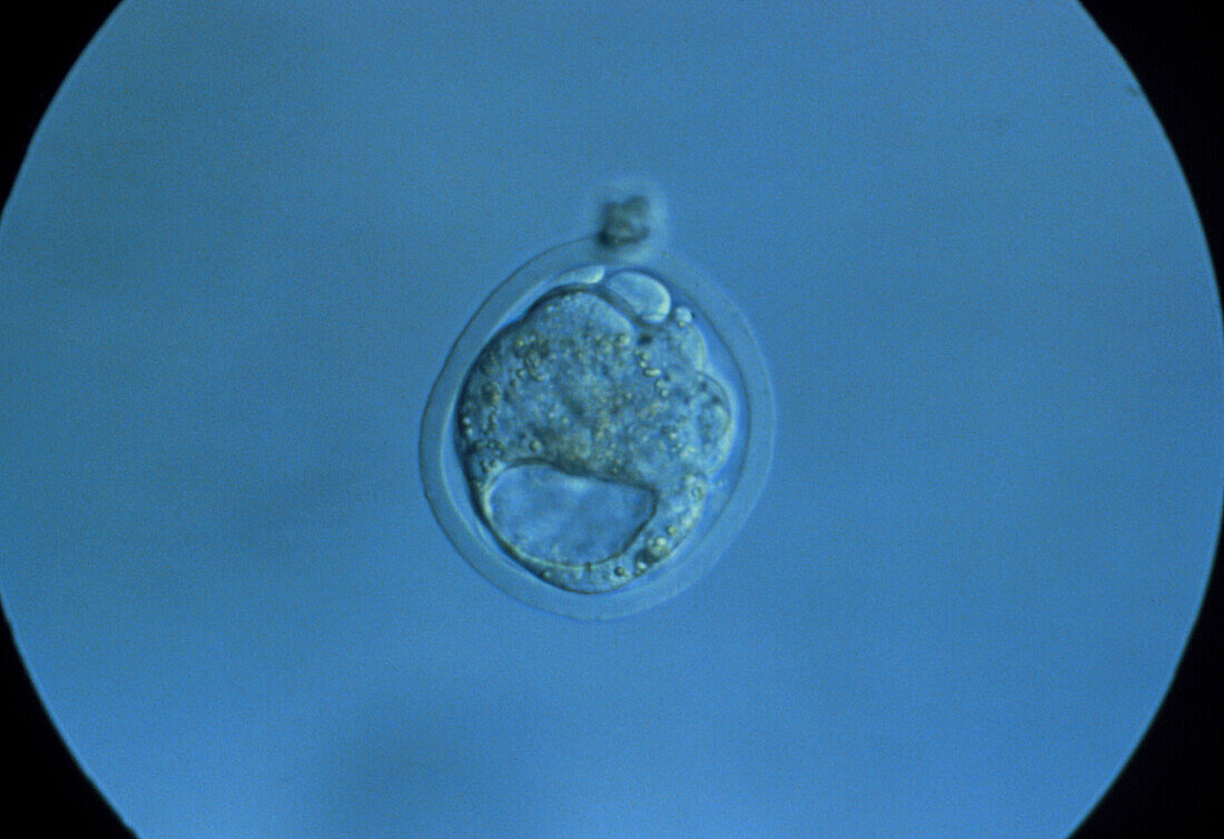 The embryo of a mouse in the blastocyst phase