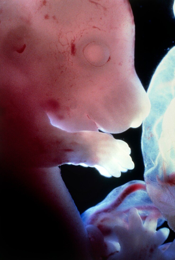 Close-up of a rat embryo at 17.5 days gestation