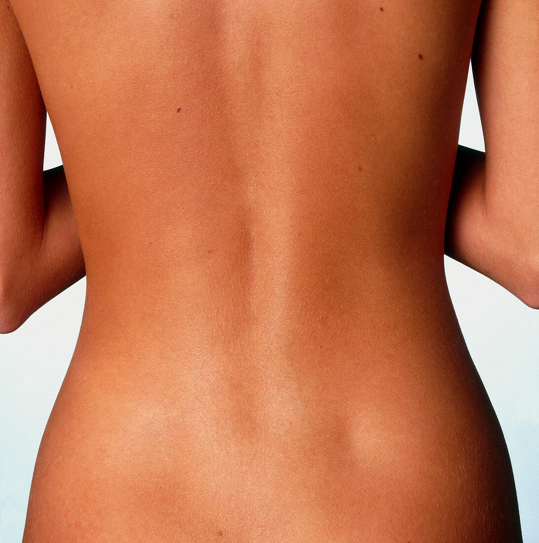 Woman's back: posterior view of the torso