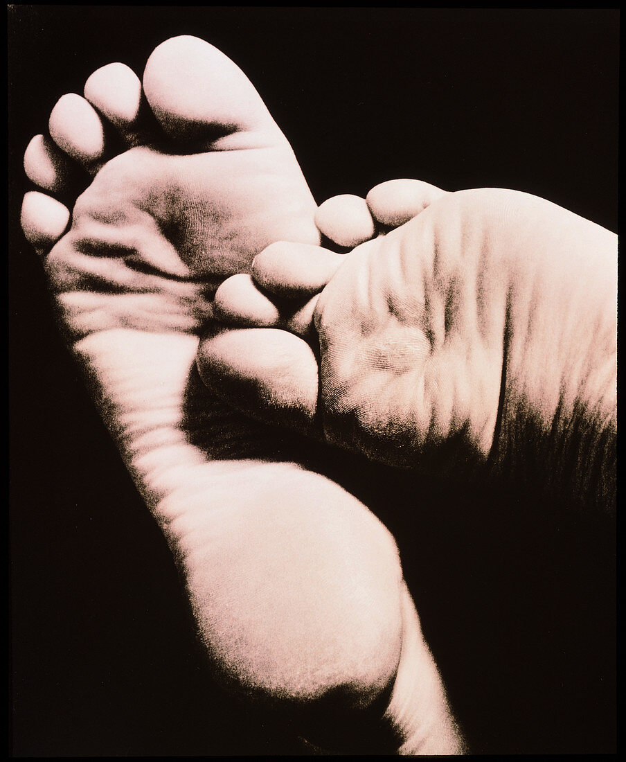 Healthy soles of the feet of a woman