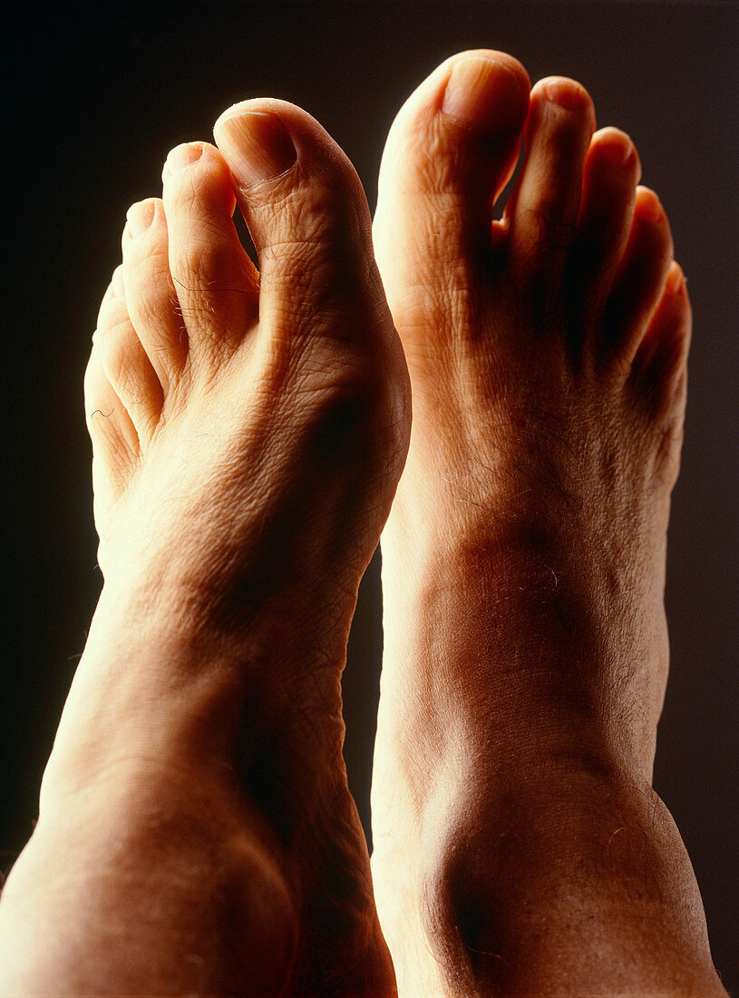 Top view of a man's healthy feet