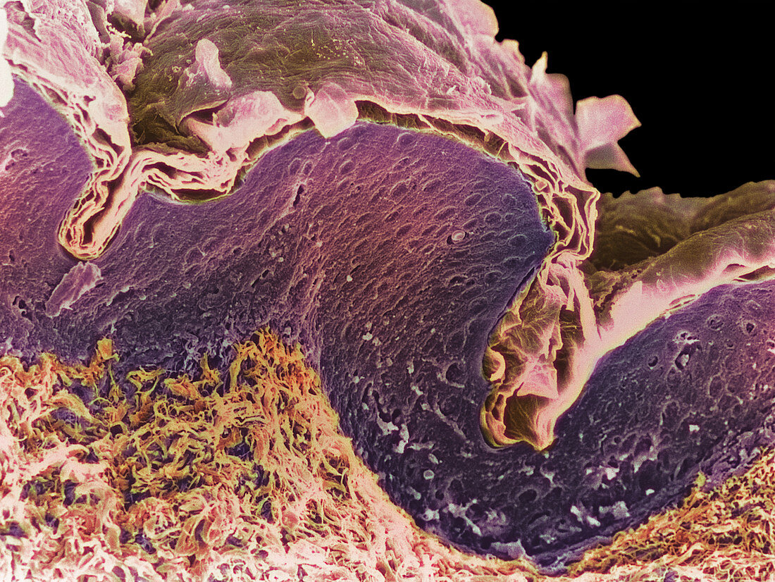 Coloured SEM of a section through skin layers