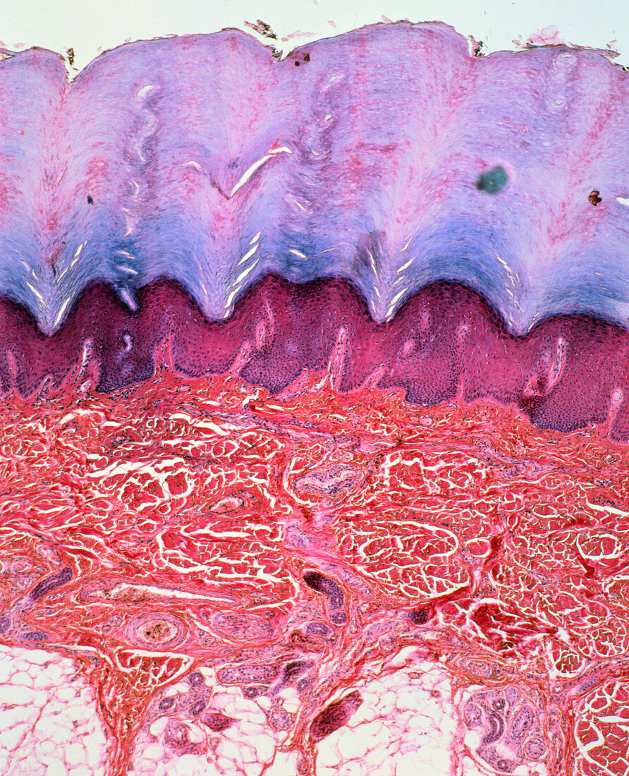 Skin section