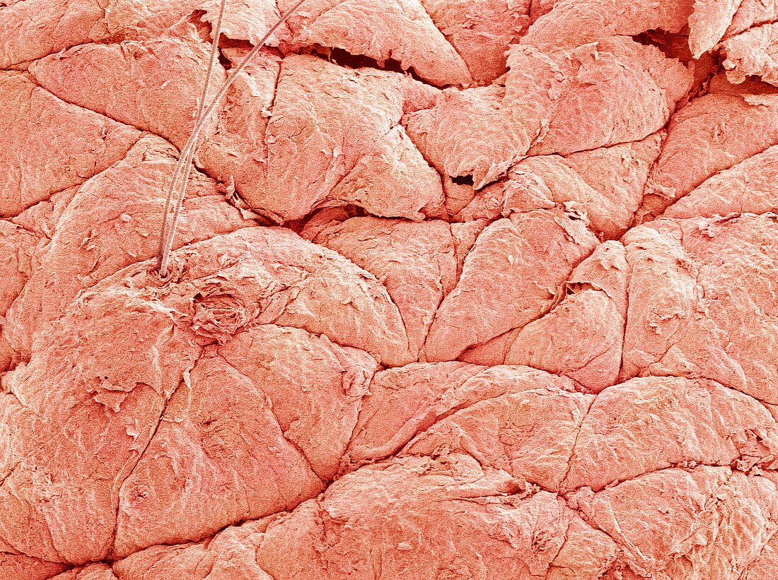 Human skin,SEM