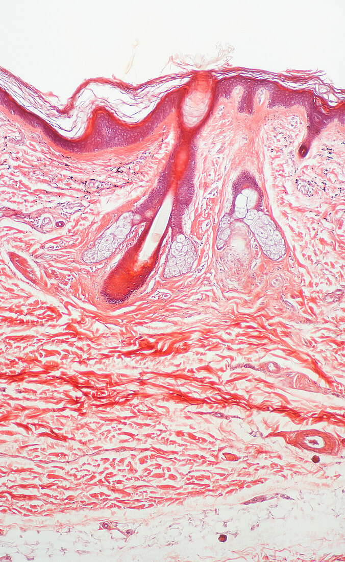 Human skin section,light micrograph