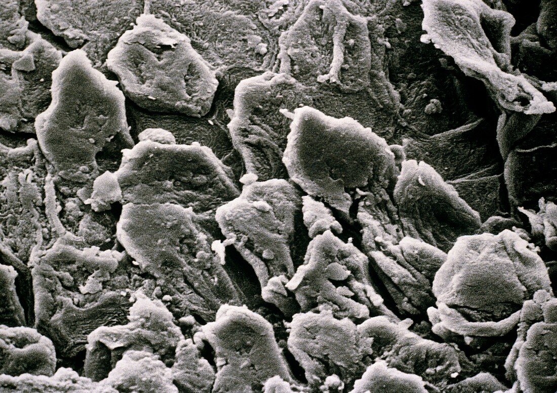 SEM of squamous epithelium from the human foot