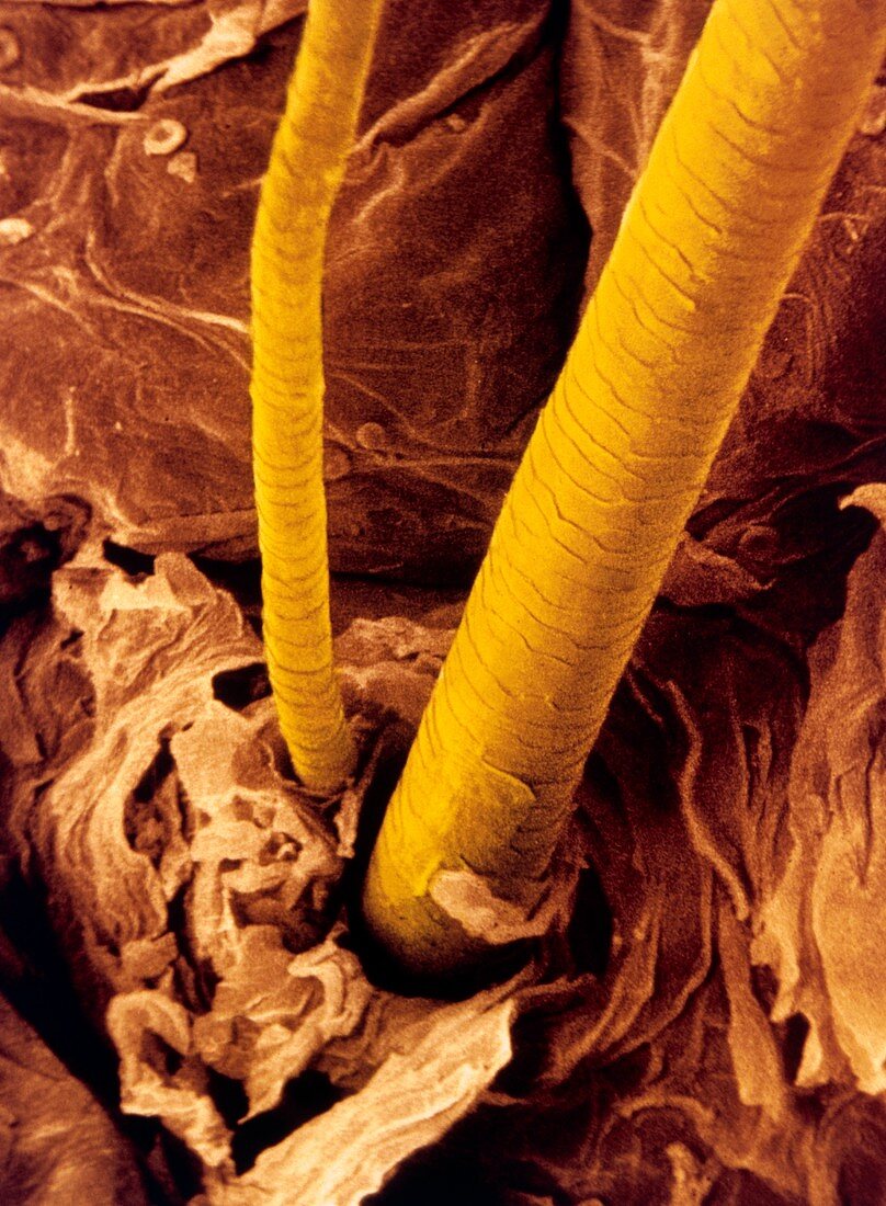 False-colour SEM of the surface of human skin