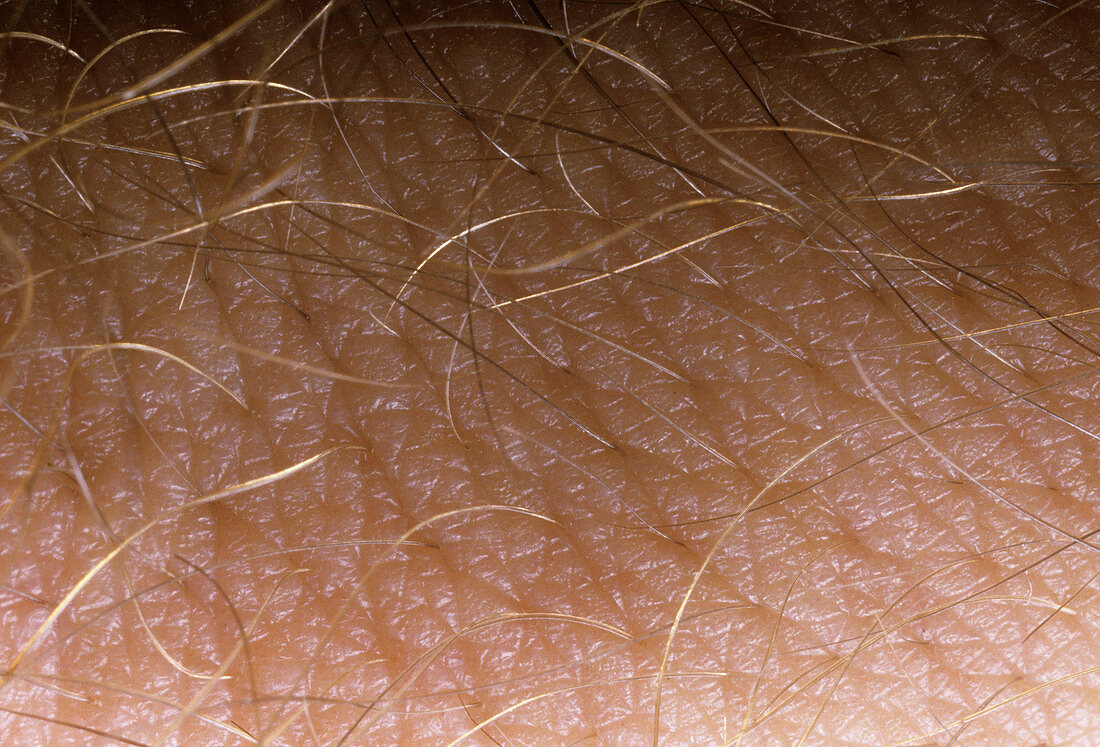 Macrophotograph of skin surface of back of a hand