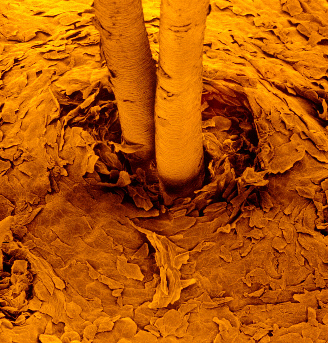 F col SEM of surface of skin from human scalp