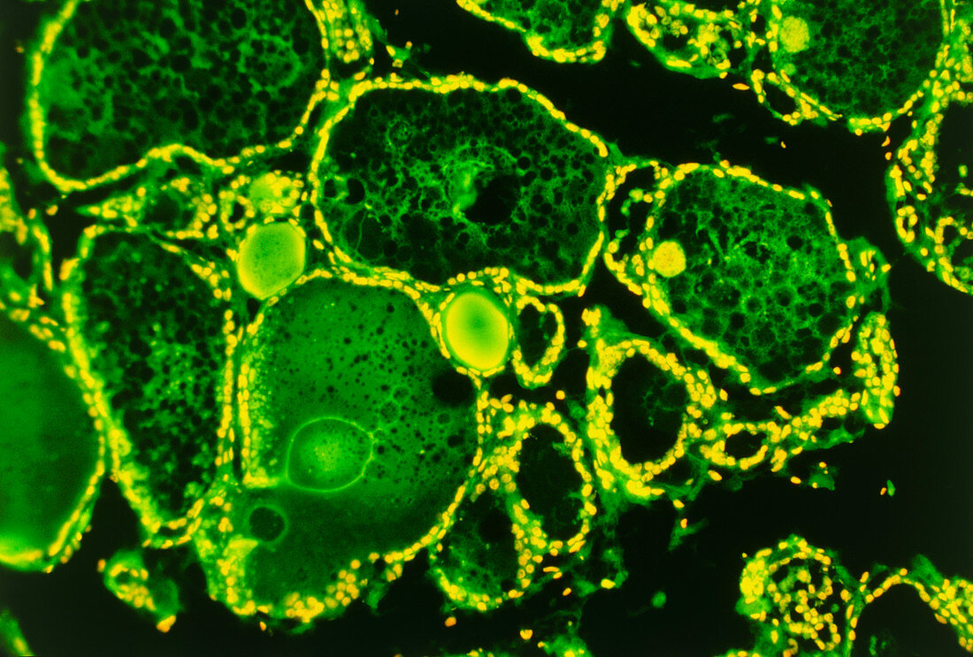 Fluorescence LM showing thyroid follicles