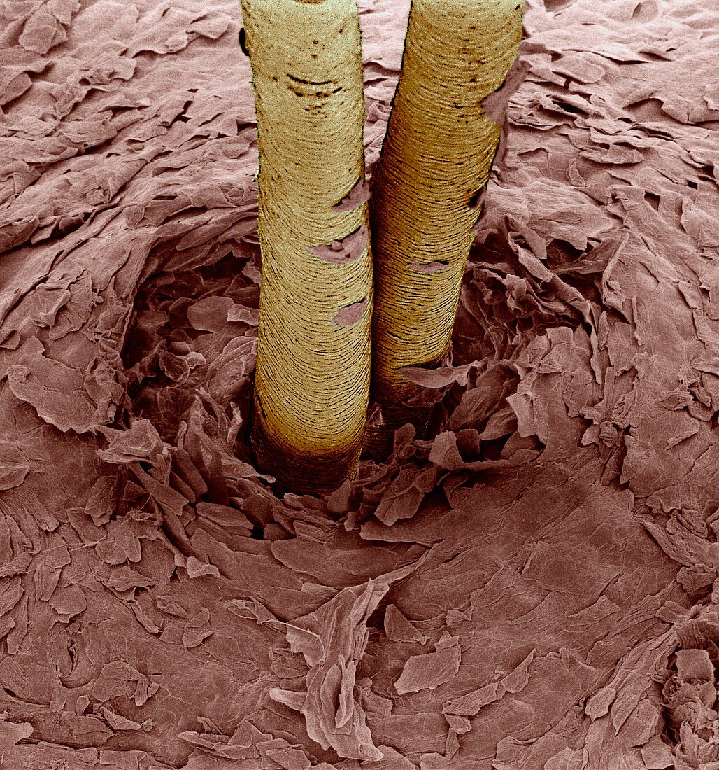 Coloured SEM of human hairs in the skin