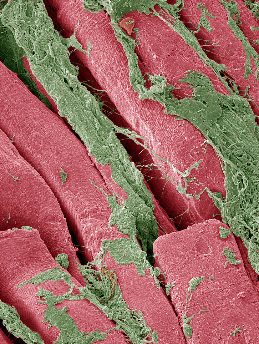 Periodontal ligament fibres,SEM