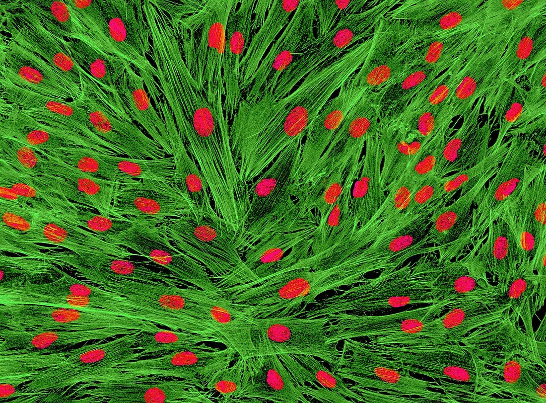 Fibroblast cells,light micrograph