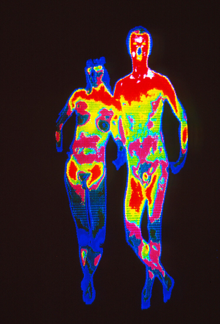 Coloured thermogram of a naked couple