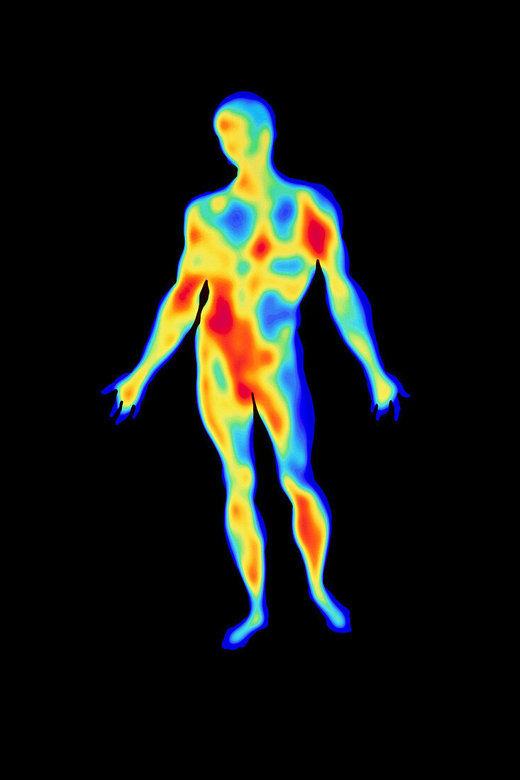 Thermogram