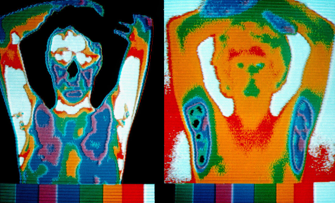 Thermographs of a man holding arms above his head