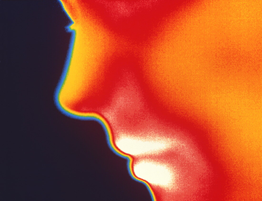 Face thermogram