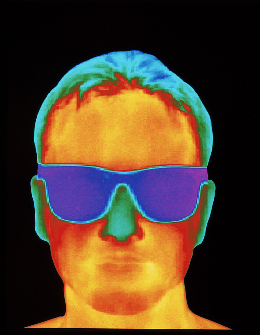 Thermogram of the front view of a man's h