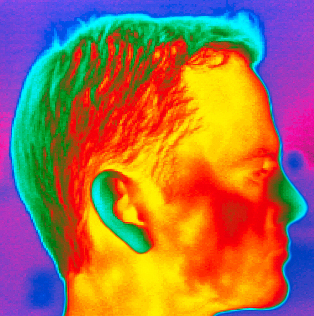Thermogram of a man's head in profile