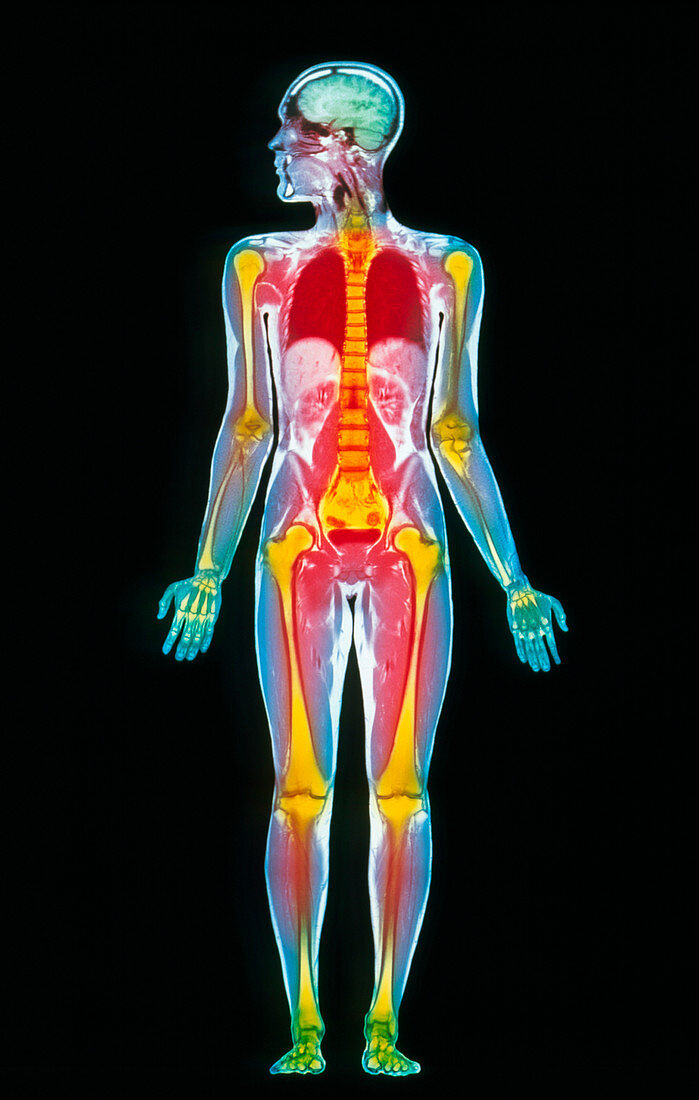 Coloured MRI whole body scan of a man
