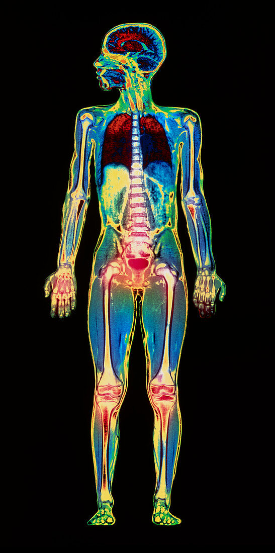 MRI child body scan
