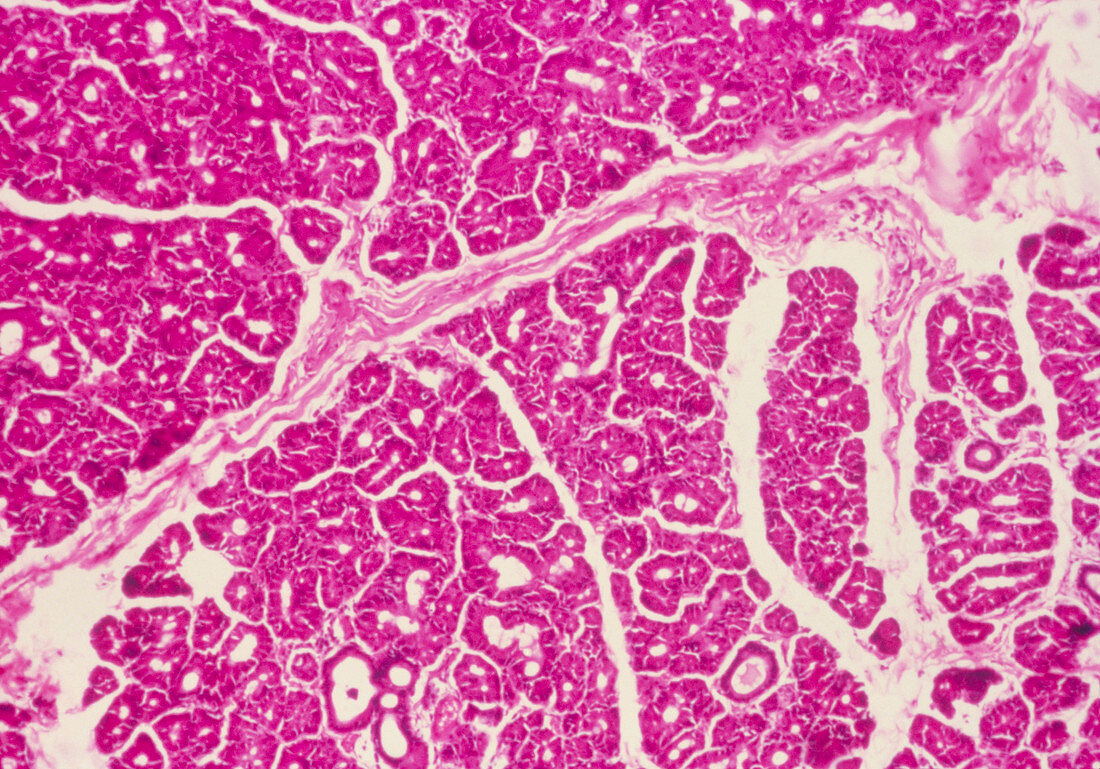 LM of a section through lacrimal gland and nerve
