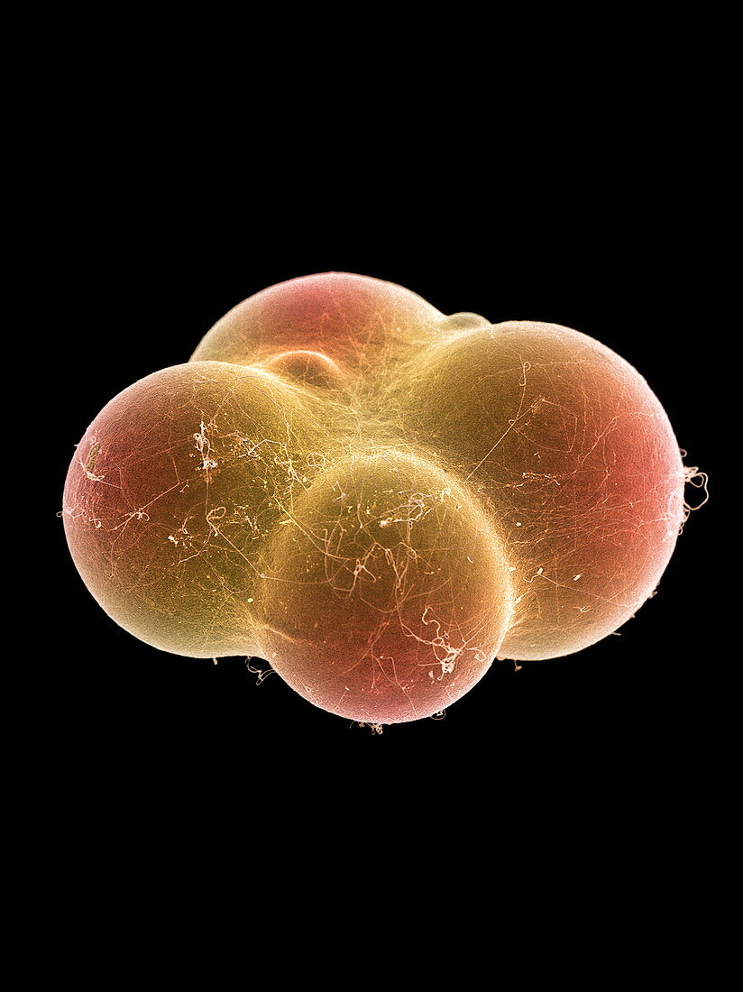 Fat cells,SEM