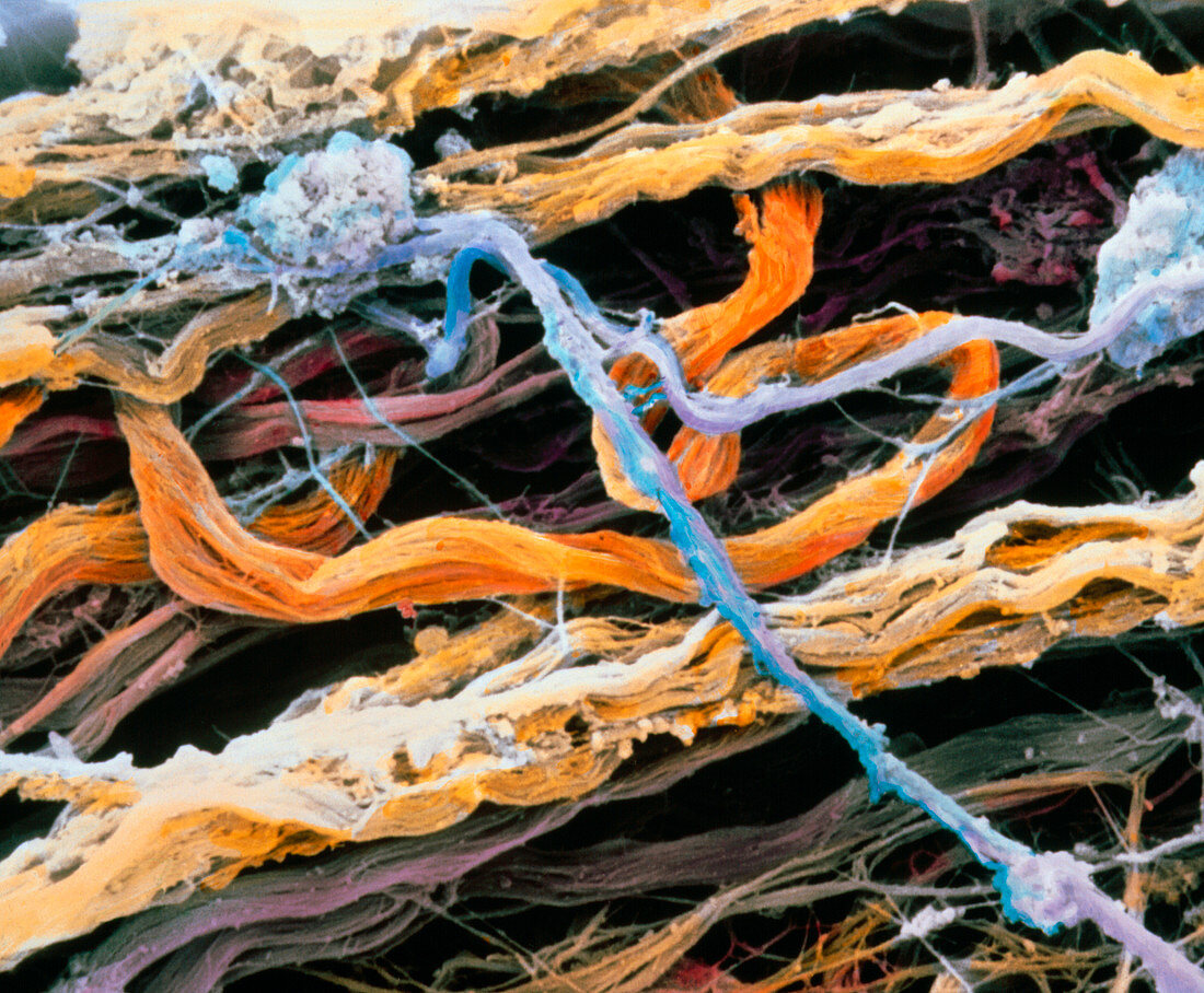 Connective tissue fibres