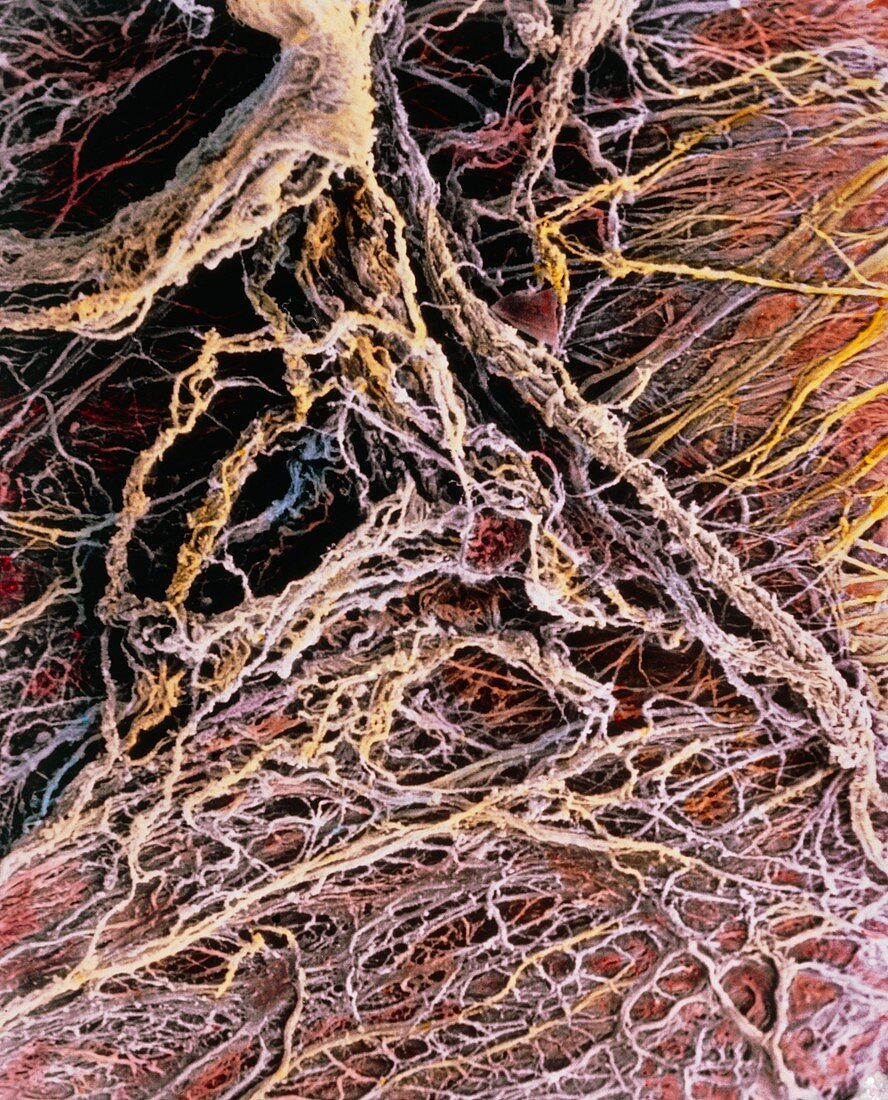 False colour SEM of connective tissue fibres