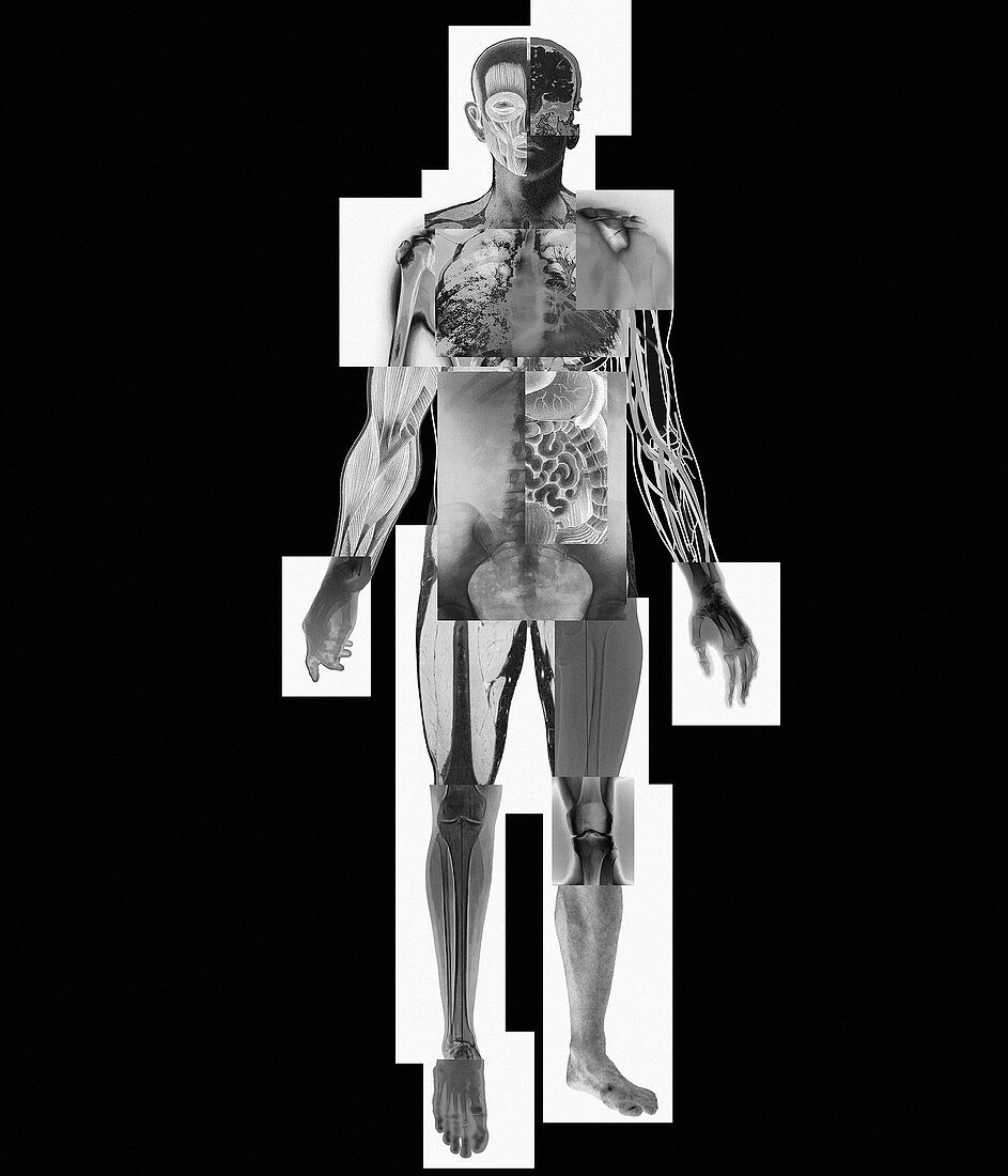 Body imaging