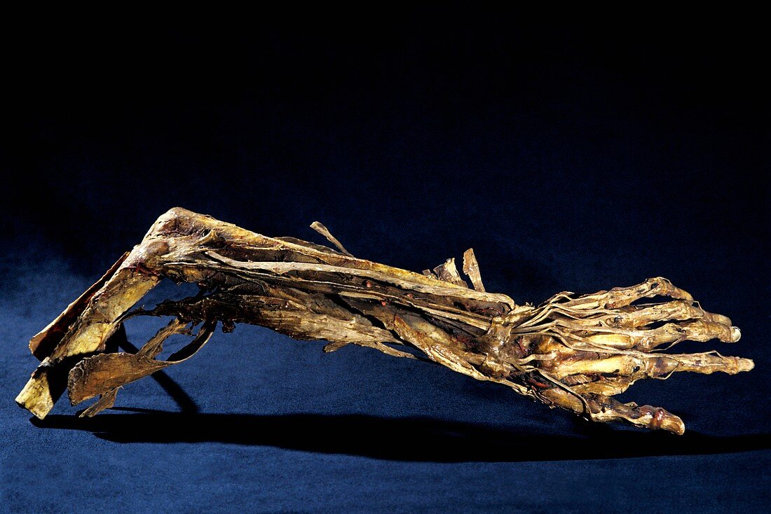 Human arm anatomy,Fragonard Museum