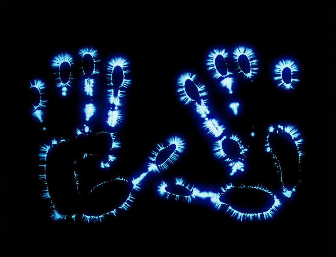 Kirlian photograph of the palms of a woman's hands
