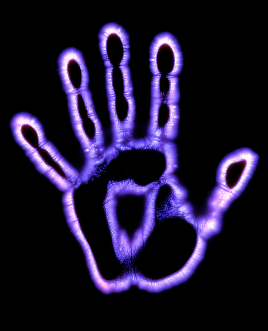 Kirlian photograph of a human hand