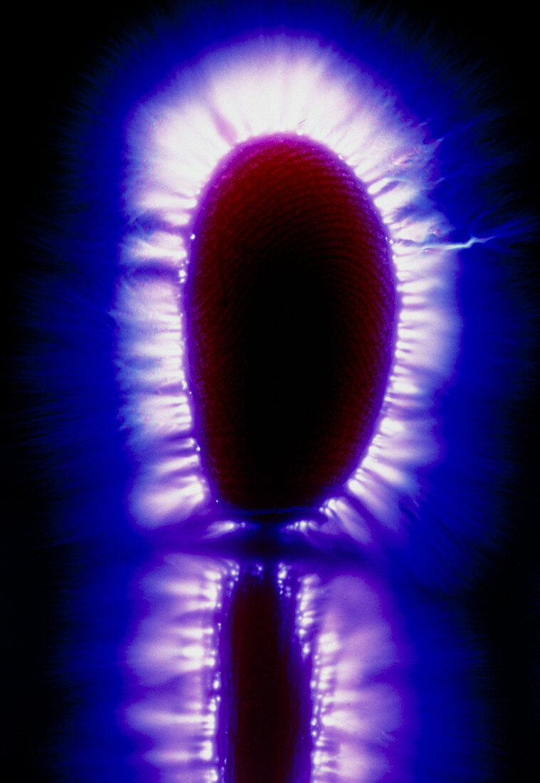 Kirlian photograph of a human fingertip