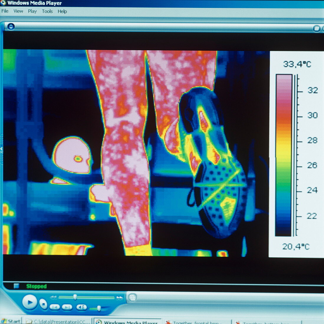 Sports trainer,thermogram
