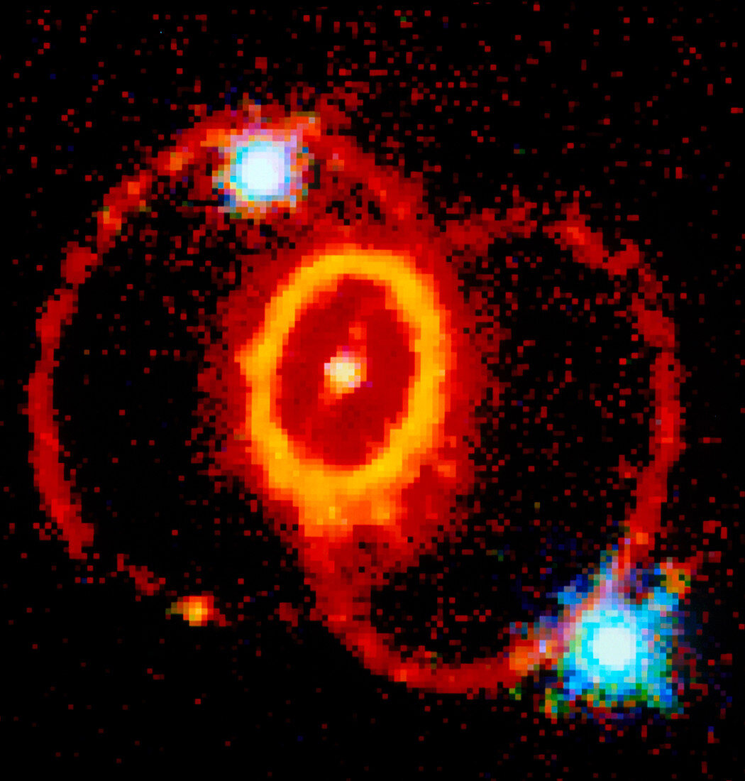 Rings around supernova remnant SN 1987a