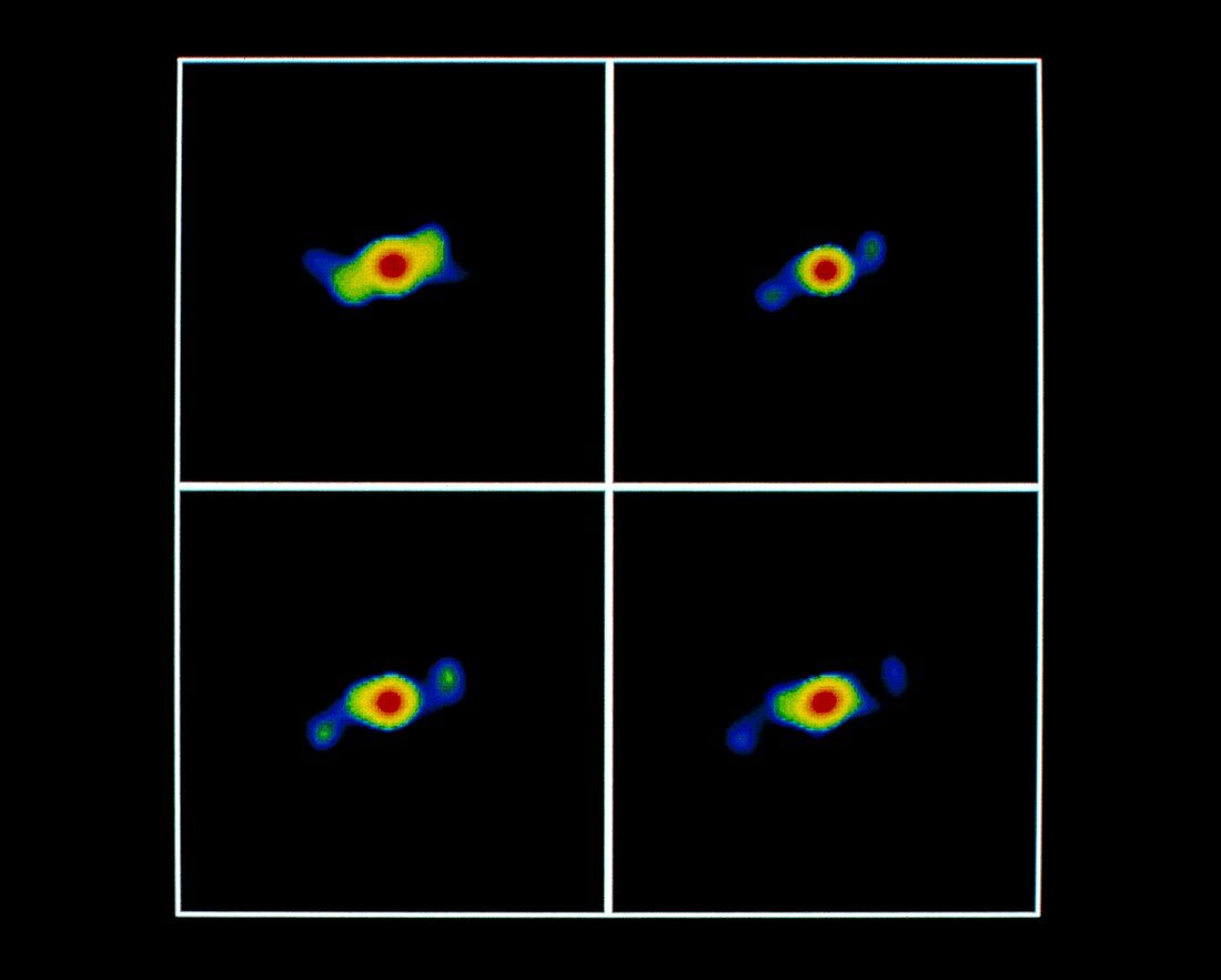 4 false-colour radio images of SS 433 showing jets