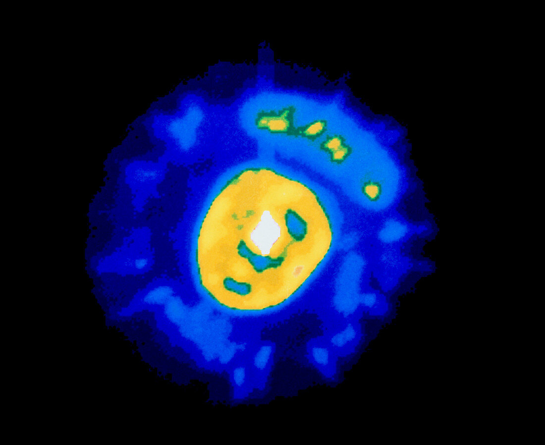 Colour-enhanced optical image of Eskimo nebula