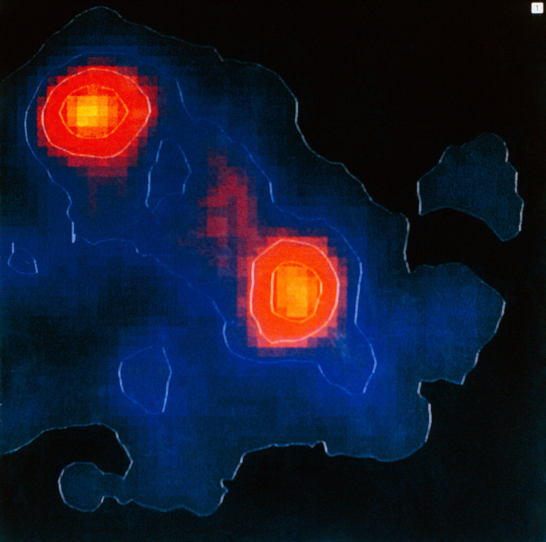 Gamma ray image of the Crab nebula