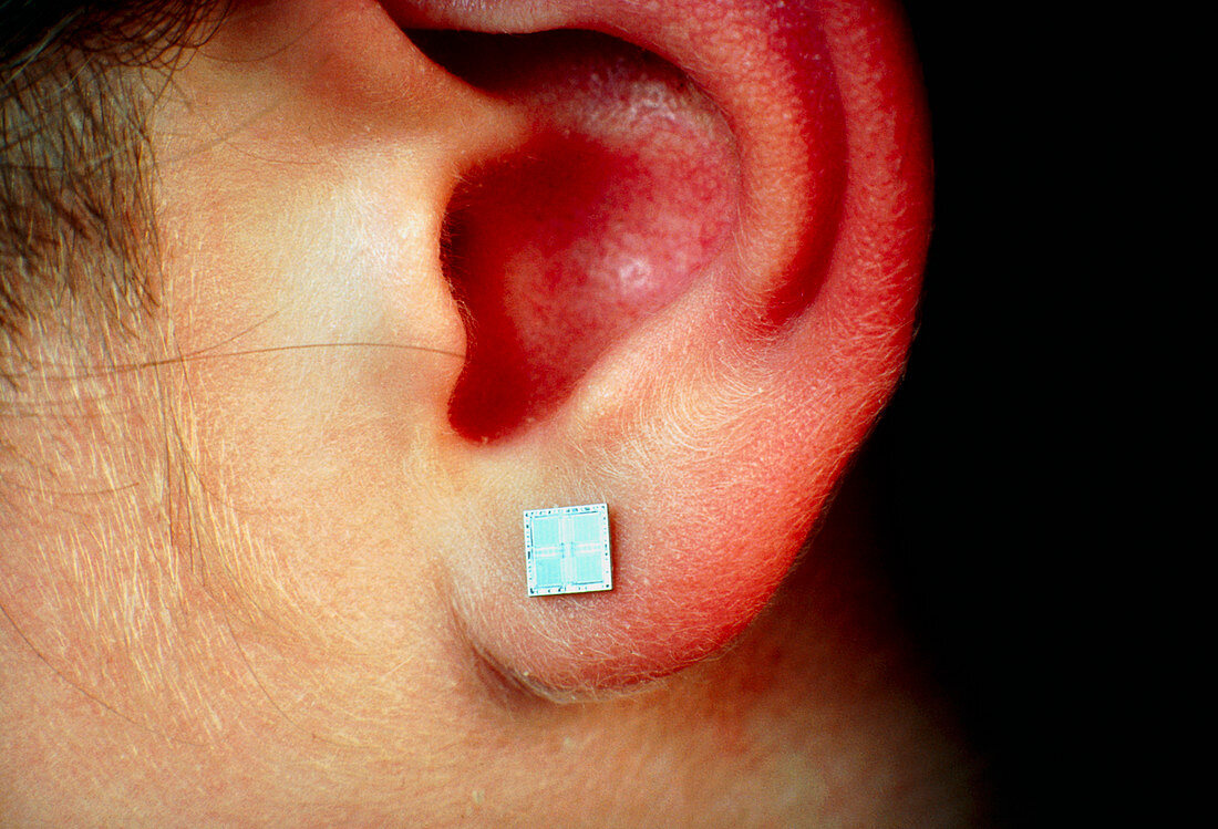 EPROM microchip on an earlobe