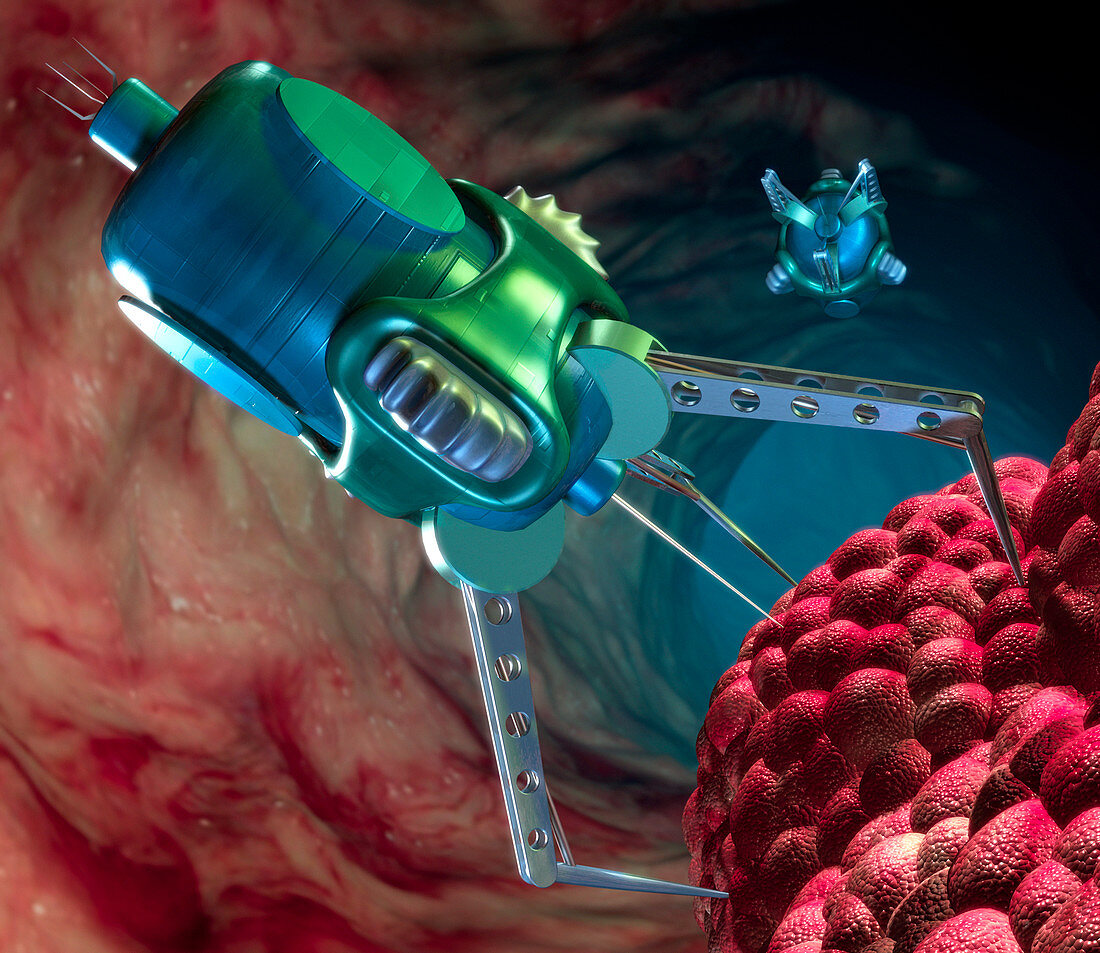 Nanorobot attacking cancer