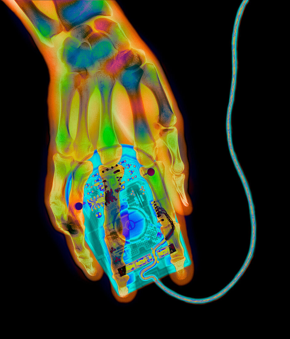 Coloured X-ray of a computer mouse and human hand