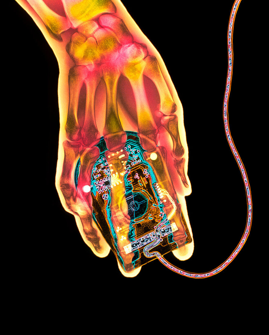 Coloured X-ray of a computer mouse and hu